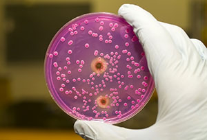 Какие инфекции вызывают цистит: патогенные и условно-патогенные микроорганизмы