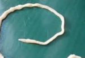 Самый длинный глист в организме человека: ленточный червь, аскарида, острица